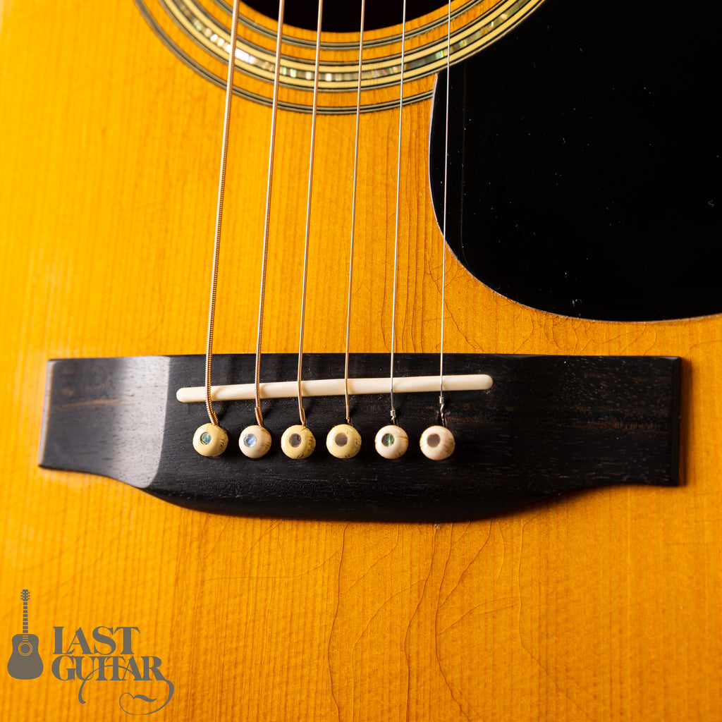 Martin D-41 ’75